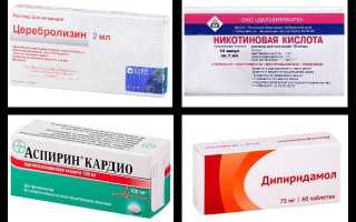 Вертебрально-базилярная недостаточность при шейном остеохондрозе