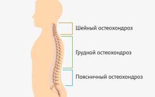 Причины и способы лечения сильной боли в шее и затылке