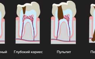 Почему болит шея: 5 причин