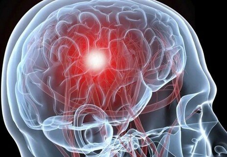 Очень болит голова слабость и еще кружиться голова