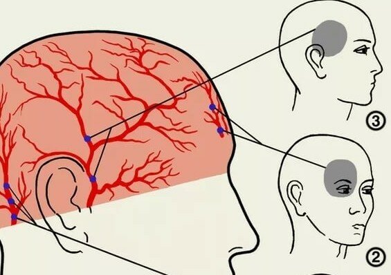 Голова болит острая боль в глазу