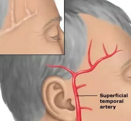 болит правый висок головы лечение