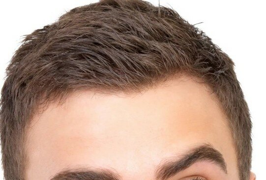 Болит голова над бровями причина