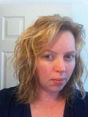 Если долго не мыть голову может болеть голова