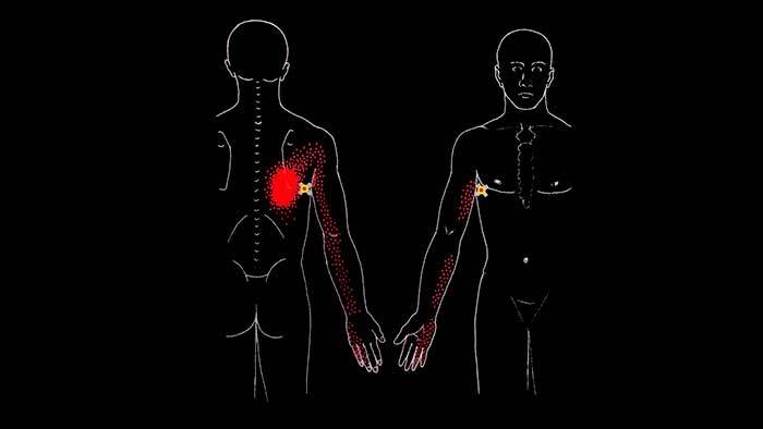 ÁÎËÈÒ ÑÏÈÍÀ  ÎÁËÀÑÒÈ ËÎÏÀÒÊÈ: øèðî÷àéøàÿ ìûøöà ñïèíû Çäîðîâüå, Ìåäèöèíà, Àíàòîìèÿ, Ñïîðò, Ôèòíåñ, Âèäåî, Ãèôêà, Äëèííîïîñò