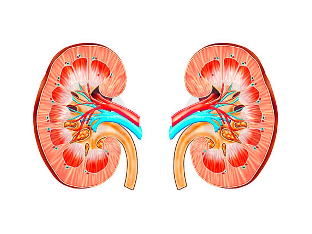 Пиелонефрит