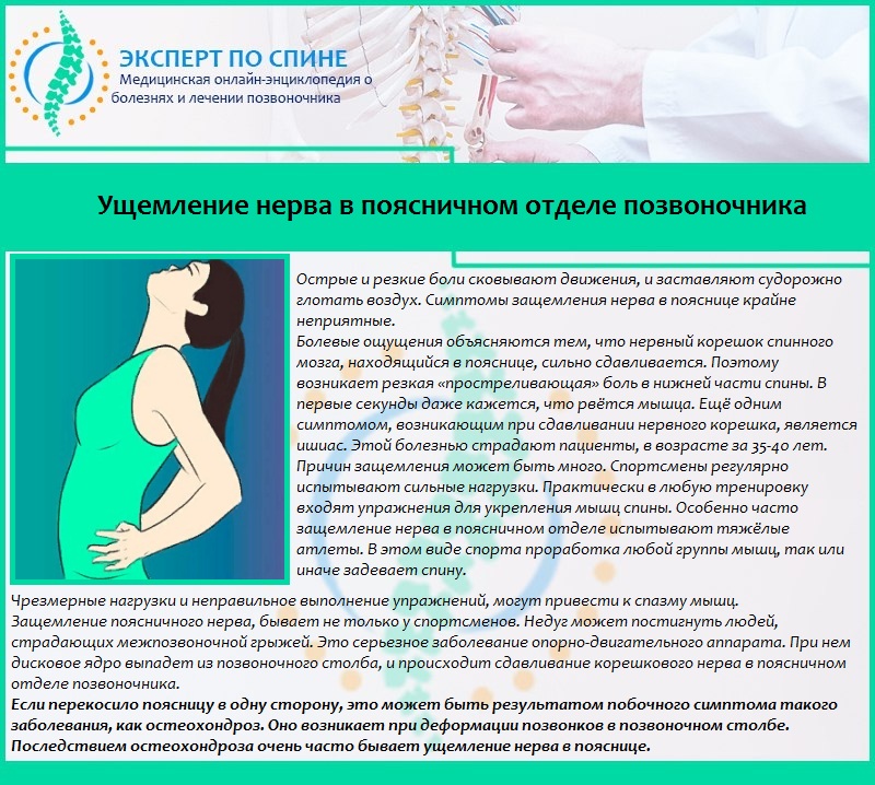 Ущемление нерва в поясничном отделе позвоночника