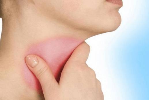 Слабость болит горло температуры нет голова тяжелая