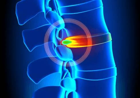 Болит под лопаткой шея и голова