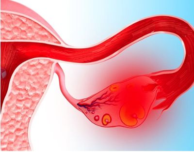 месячные прошли а спина болит