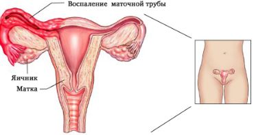 месячные прошли а спина болит
