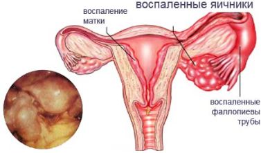 месячные прошли а спина болит