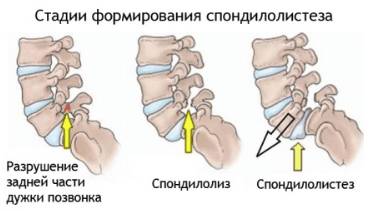 Когда болит спина по ночам
