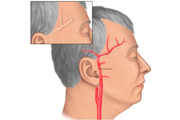 Постоянно болит голова таблетки не помогают что делать