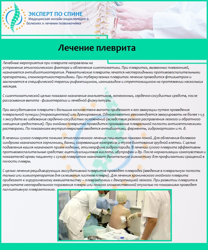 Лечение плеврита