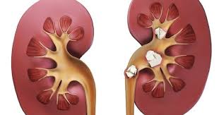 боль в почках у детей боль в почках у детей