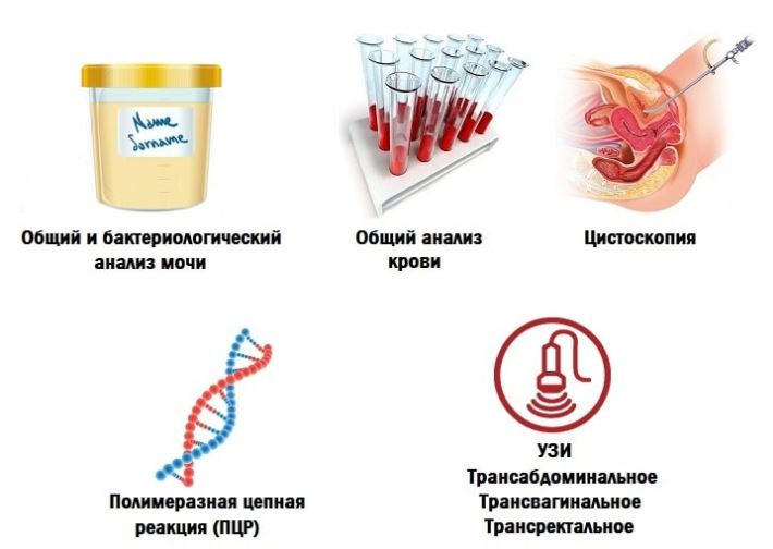 Почему при цистите болит спина