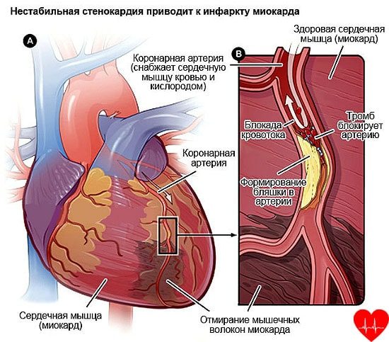 Болит сильно спина справа