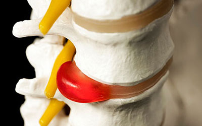 Когда болит спина по ночам