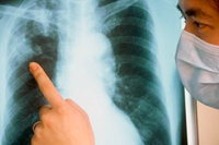 Наклоняю голову болит горло