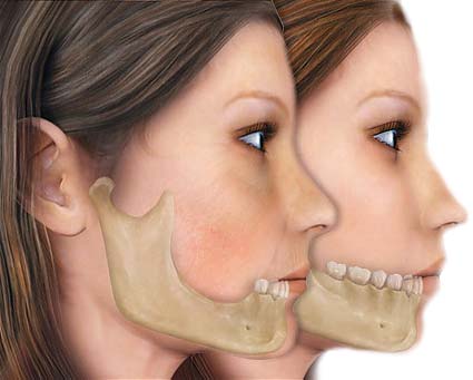 Нижняя челюсть женщины вид сбоку