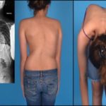 болит в грудине посередине отдающая в спину