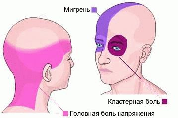 Постоянно болит голова таблетки не помогают что делать